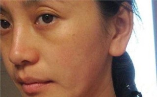 百家号:白小姐期期开奖一肖一特-脸色发黄是什么原因