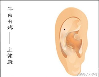 搜狐:2024新澳彩免费资料-耳垂长痘痘是什么原因