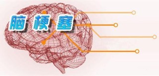 搜狗订阅:2024澳门正版精准资料-脑梗塞吃什么食物好