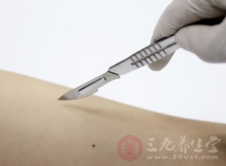 百度平台:最准一肖一码一一子中特-术后吃什么伤口愈合快