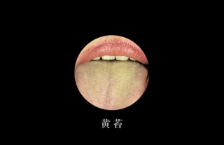 百度平台:澳门最准的资料免费公开-舌苔黄腻是什么原因