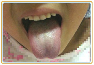 百度平台:澳门最准的资料免费公开-舌苔黄腻是什么原因