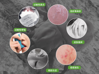 腾讯：2023澳门资料大全免费-螨虫是什么样子