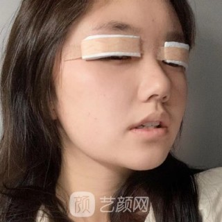 抖音视频:2024年新奥开奖结果如何-哪个明星割双眼皮