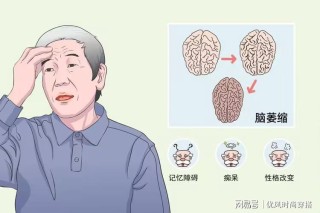 搜狐订阅：管家婆2024年正版资料大全-小脑梗塞会出现什么症状