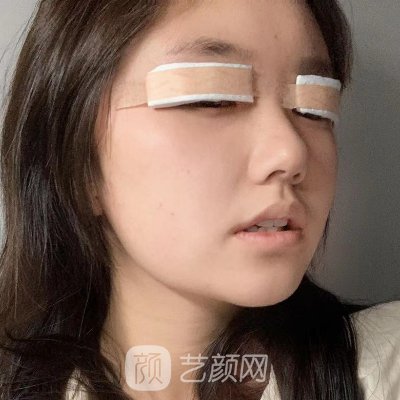 抖音视频:2024年新奥开奖结果如何-哪个明星割双眼皮  第3张