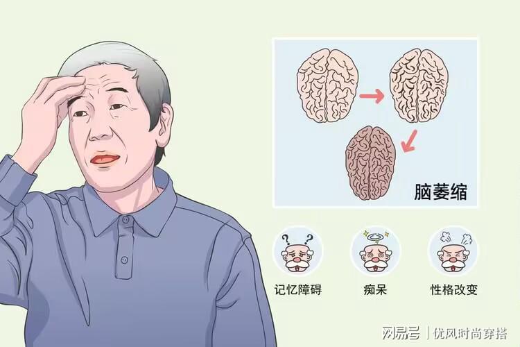 搜狐订阅：管家婆2024年正版资料大全-小脑梗塞会出现什么症状  第1张