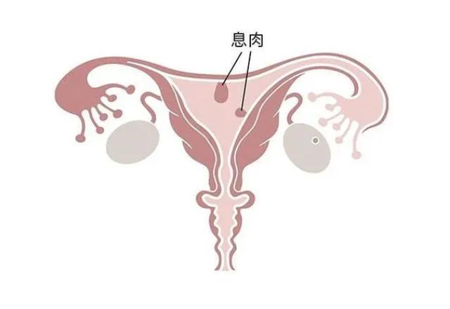 微博:今晚澳门开准确生肖12月4日-什么是宫颈息肉  第1张