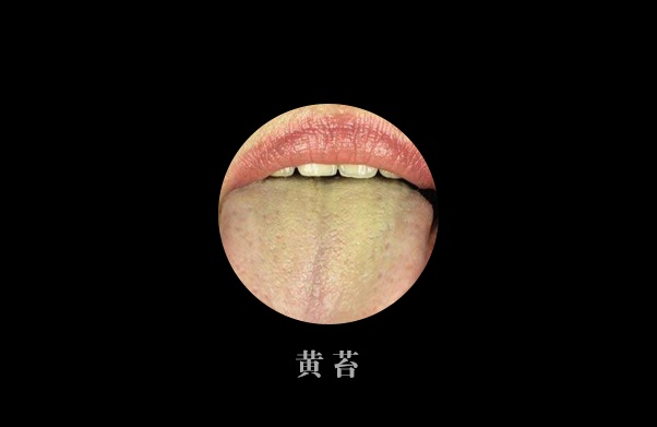 百度平台:澳门最准的资料免费公开-舌苔黄腻是什么原因  第2张