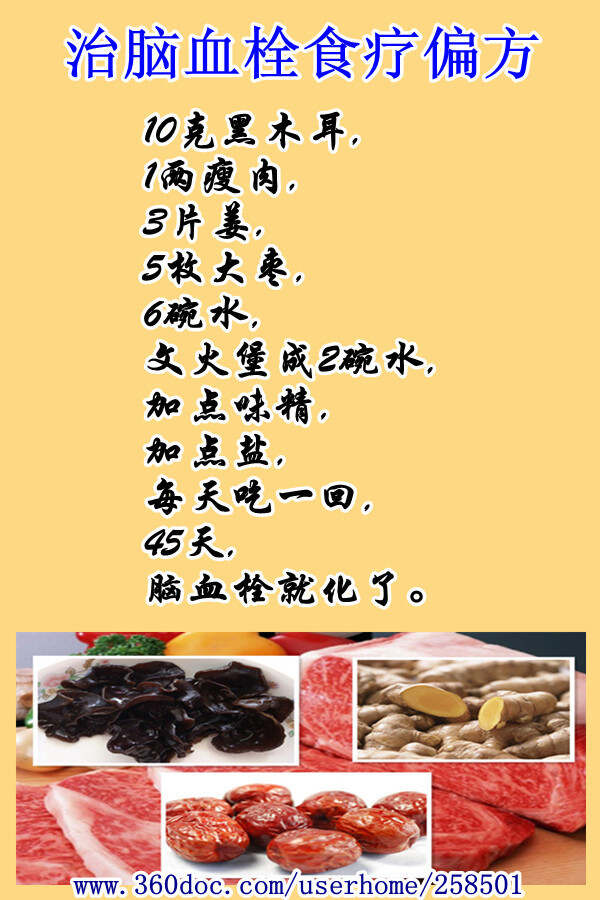 搜狗订阅:2024澳门正版精准资料-脑梗塞吃什么食物好  第1张
